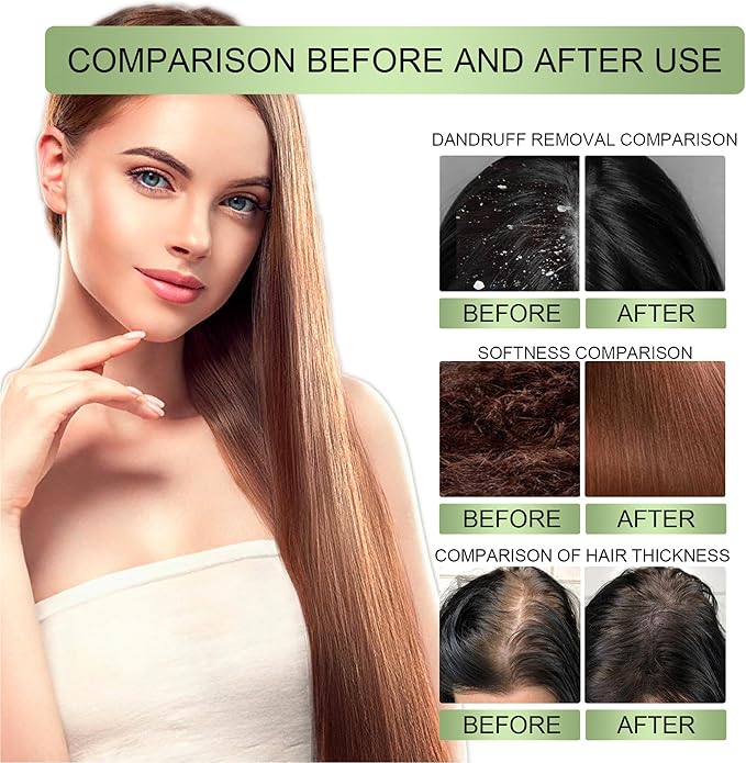 Before and after comparison graphic for Adivasi Hair Oil showing dandruff removal, hair softness, and hair thickness improvements.
